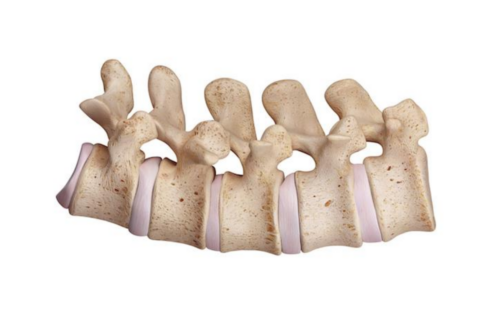 sigmd for spinal impairment assessment