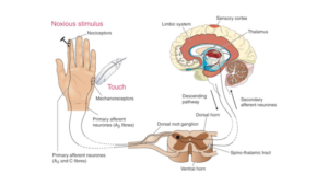 Dr Peter Blombery on chronic pain and pain measurement 1 Pain pathways - Lex Medicus Publishing