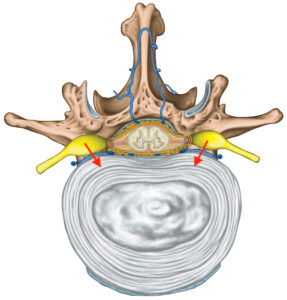 Cross section of the vertebra showing the dorsal root ganglia 