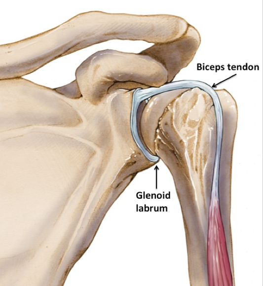 Bankart and Hill-Sachs lesions of the shoulder joint 7 Illustration of the glenoid labrum with the insertion of the long biceps tendon .