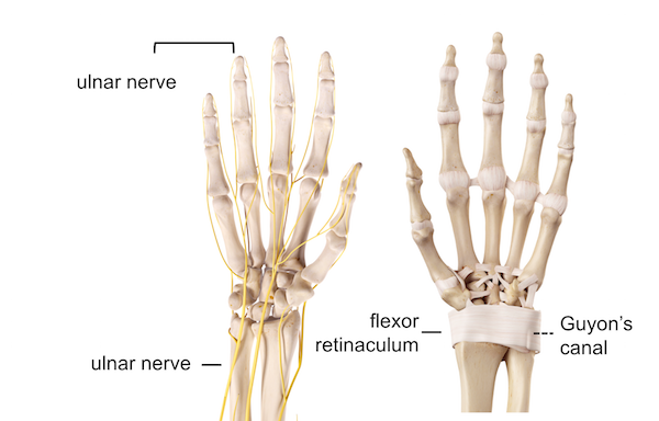 Ulnar nerve entrapment 3 Image of the ulnar nerve and the Guyon's canal seen from the palmar side the hand