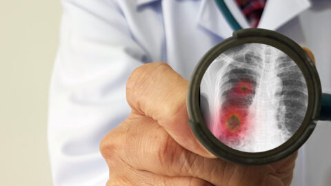 infectious,doctor,exam,and,screening,new,corona,virus,infection,or